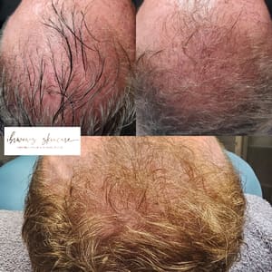 Permanent makeup work by Ibrwows skincare studio Alpharetta in Alpharetta, GA
