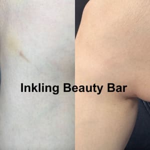 Permanent makeup work by Inkling Beauty Bar in San Francisco, CA