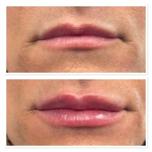 Permanent makeup work by La Medspa in Montgomery, AL