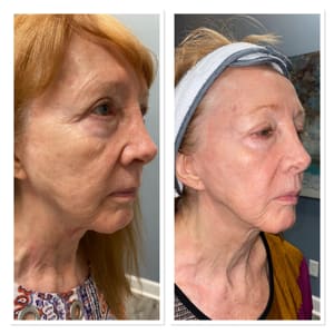 Permanent makeup work by La Medspa in Montgomery, AL