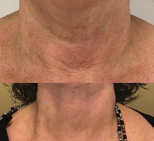 Permanent makeup work by Lauren Jewel Aesthetics in Jefferson, GA