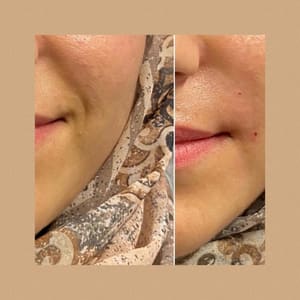 Permanent makeup work by Lavender Med Spa in Duluth, GA