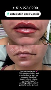 Permanent makeup work by Lotus Skin Care Center in Massapequa, NY