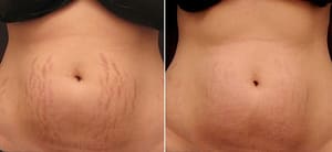 Permanent makeup work by Meraki Beauty Bar in Scottsdale, AZ