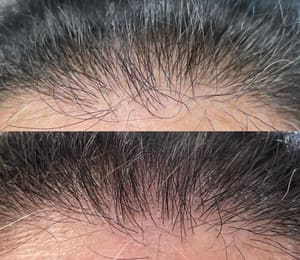 Permanent makeup work by Microblading by FYSTYBROWZ Trainer & PMU Artist Los Angeles in Walpole, MA