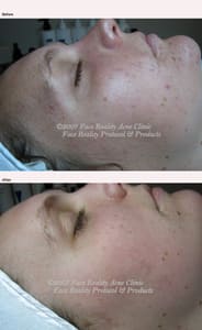 Permanent makeup work by MY Skin Care & Electrolysis in Fair Lawn, NJ