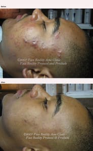 Permanent makeup work by MY Skin Care & Electrolysis in Fair Lawn, NJ