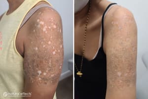 Permanent makeup work by Natural Effects Medical Tattooing in Pearland, TX