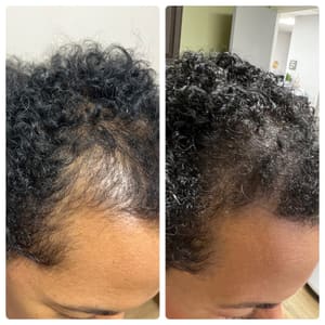 Permanent makeup work by Nishé Aesthetics in Old Bridge, NJ