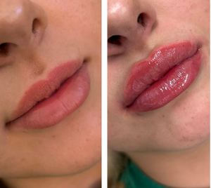 Permanent makeup work by Noydeen Med Spa of Conway Arkansas in Conway, AR