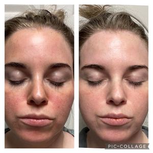 Permanent makeup work by Noydeen Med Spa of Conway Arkansas in Conway, AR
