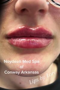 Permanent makeup work by Noydeen Med Spa of Conway Arkansas in Conway, AR
