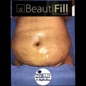 Permanent makeup work by Palmetto Medicine & Aesthetics in Aiken, SC