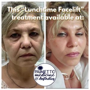 Permanent makeup work by Palmetto Medicine & Aesthetics in Aiken, SC