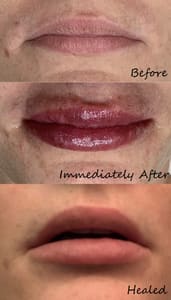 Permanent makeup work by Permanently Yours, Amy in Texarkana, TX