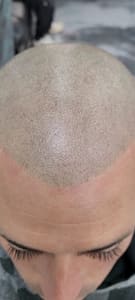 Permanent makeup work by Peterjayhairink scalp Micropigmentation in Tulsa, OK