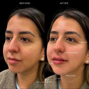 Permanent makeup work by Quantum Wellness Med Spa Chandler in Chandler, AZ