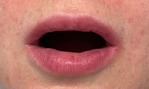 Permanent makeup work by Quantum Wellness Med Spa Chandler in Chandler, AZ