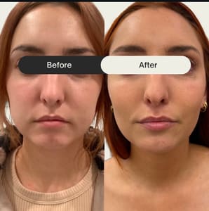 Permanent makeup work by Quantum Wellness Med Spa Chandler in Chandler, AZ