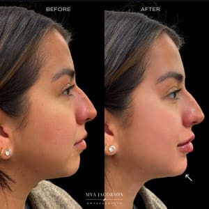 Permanent makeup work by Quantum Wellness Med Spa Chandler in Chandler, AZ