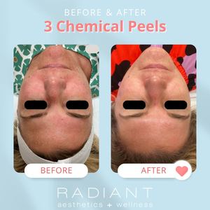 Permanent makeup work by Radiant Aesthetics and Wellness in Evans, GA