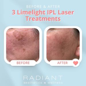 Permanent makeup work by Radiant Aesthetics and Wellness in Evans, GA