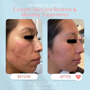Permanent makeup work by Radiant Aesthetics and Wellness in Evans, GA