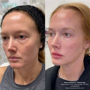 Permanent makeup work by Revive Aesthetics - Chattanooga in Chattanooga, TN