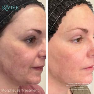 Permanent makeup work by Revive Aesthetics - Cleveland in Cleveland, TN