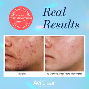Permanent makeup work by Revolution Med Spa in Cabot, AR