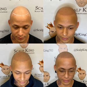 Permanent makeup work by Scalp King - Hair tattoo in Glendale, CA