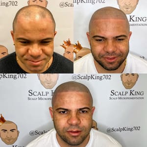 Permanent makeup work by Scalp King - Hair tattoo in Glendale, CA