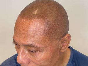 Permanent makeup work by Scalp Masters Atlanta in Atlanta, GA