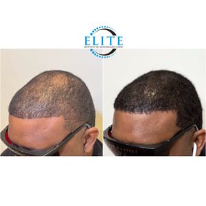 Permanent makeup work by Scalp Masters Atlanta in Atlanta, GA