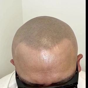 Permanent makeup work by Scalp Masters Atlanta in Atlanta, GA