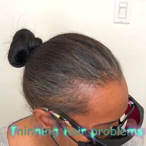 Permanent makeup work by Scalp Masters Atlanta in Atlanta, GA