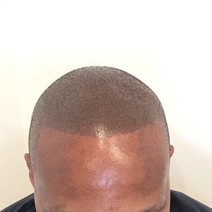 Permanent makeup work by Scalp Masters Atlanta in Atlanta, GA