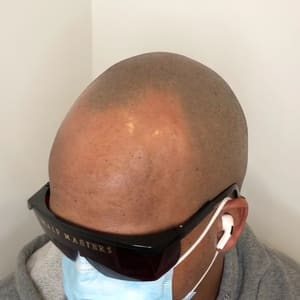 Permanent makeup work by Scalp Masters Atlanta in Atlanta, GA