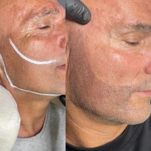 Permanent makeup work by Scalp Micro M3 in San Marcos, CA