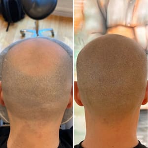 Permanent makeup work by Scalp Micro USA - Chicago, IL in Chicago, IL