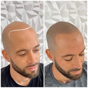 Permanent makeup work by Scalp Micro USA - Chicago, IL in Chicago, IL