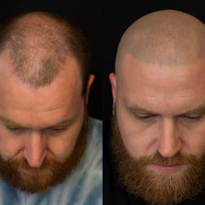 Permanent makeup work by Scalp Micropigmentation By Steven Bradley in Grovetown, GA