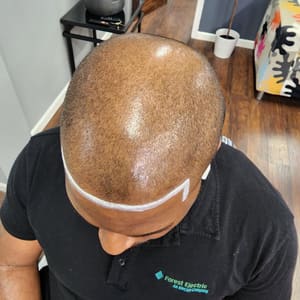 Permanent makeup work by Scalp & Skin Artistry Scalp Micropigmentation in West Hempstead, NY