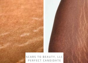 Permanent makeup work by Scars to Beauty LLC in Stockbridge, GA