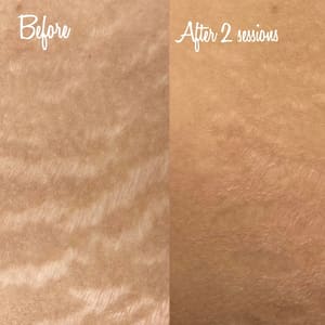 Permanent makeup work by Scars to Beauty LLC in Stockbridge, GA