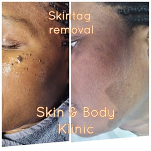 Permanent makeup work by Skin and Body Klinic Aesthetic & Wellness Center in Mt Laurel Township, NJ