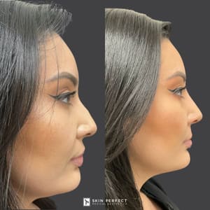 Permanent makeup work by Skin Perfect Medical Aesthetics in Costa Mesa, CA