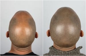 Permanent makeup work by SMP Hair Creations in Jacksonville, FL