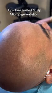 Permanent makeup work by Subtle Solutions Scalp Micropigmentation in Anthem, AZ