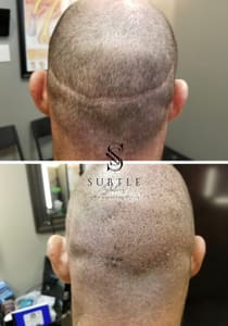 Permanent makeup work by Subtle Solutions Scalp Micropigmentation in Anthem, AZ